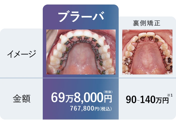 ブラーバの特徴と価格
